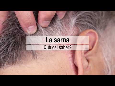 Video: Cómo prevenir la sarna: 9 pasos (con imágenes)