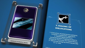 Radiology of Skeletal Trauma