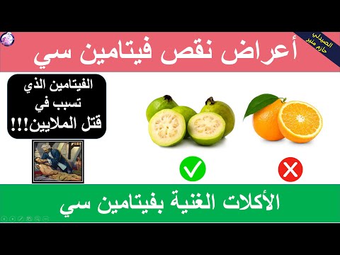 اعراض نقص فيتامين سي - الاطعمة الغنية بفيتامين سي - تقوية المناعة