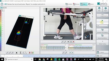 Zebris software example 1