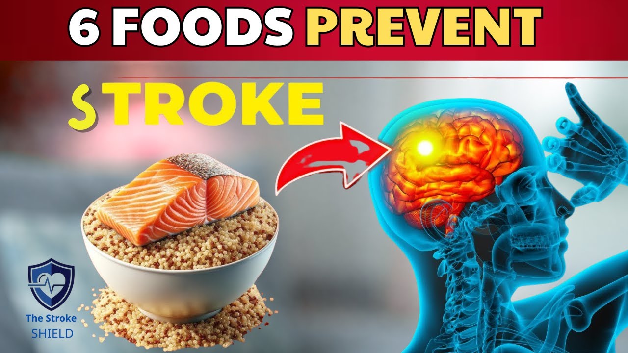 Top 6 Foods to "Unclog" Brain Arteries (Doctor's List)