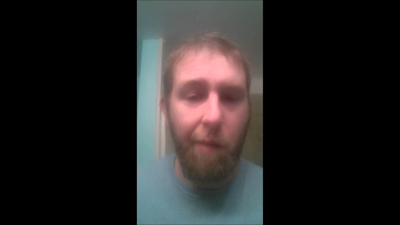 Ramsay Hunt syndrome day 1 - YouTube