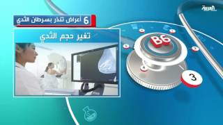 6 أعراض تنذر بسرطان الثدي