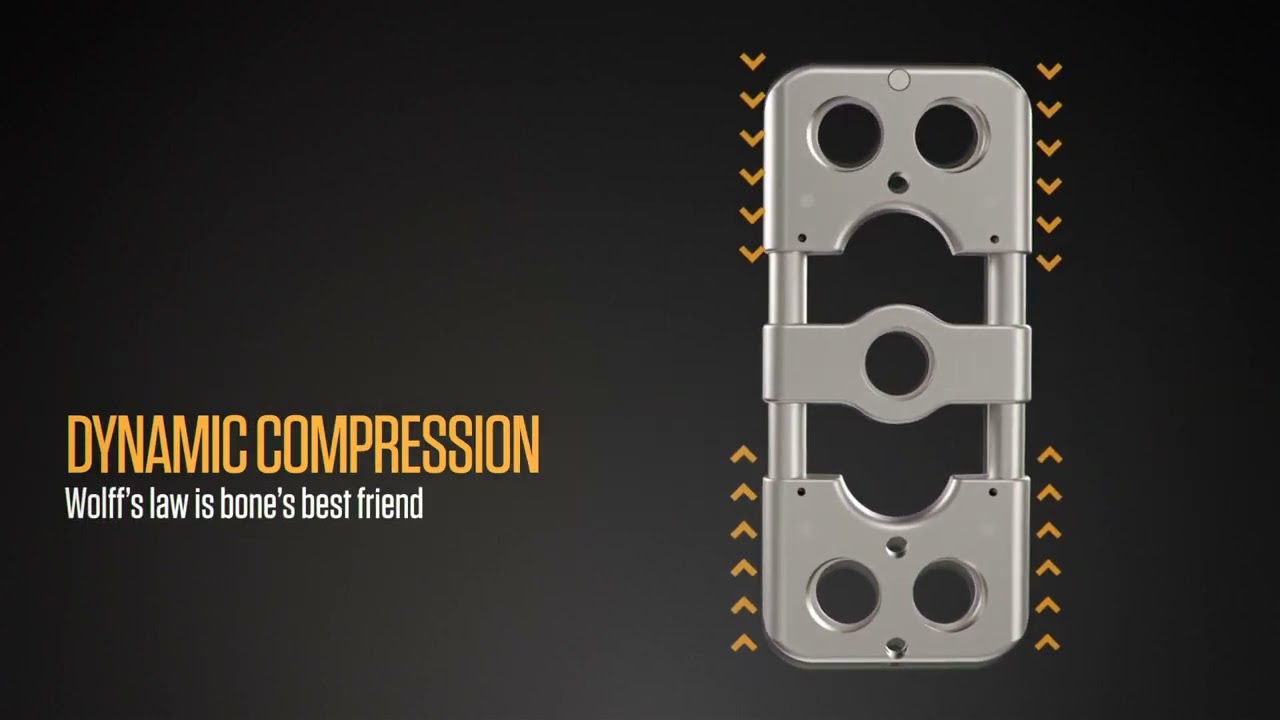 Nexus Spine Active™