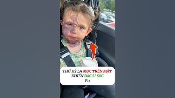 [P.1] Thú kì lạ mọc trên mặt khiến bác sĩ sốc #shorts