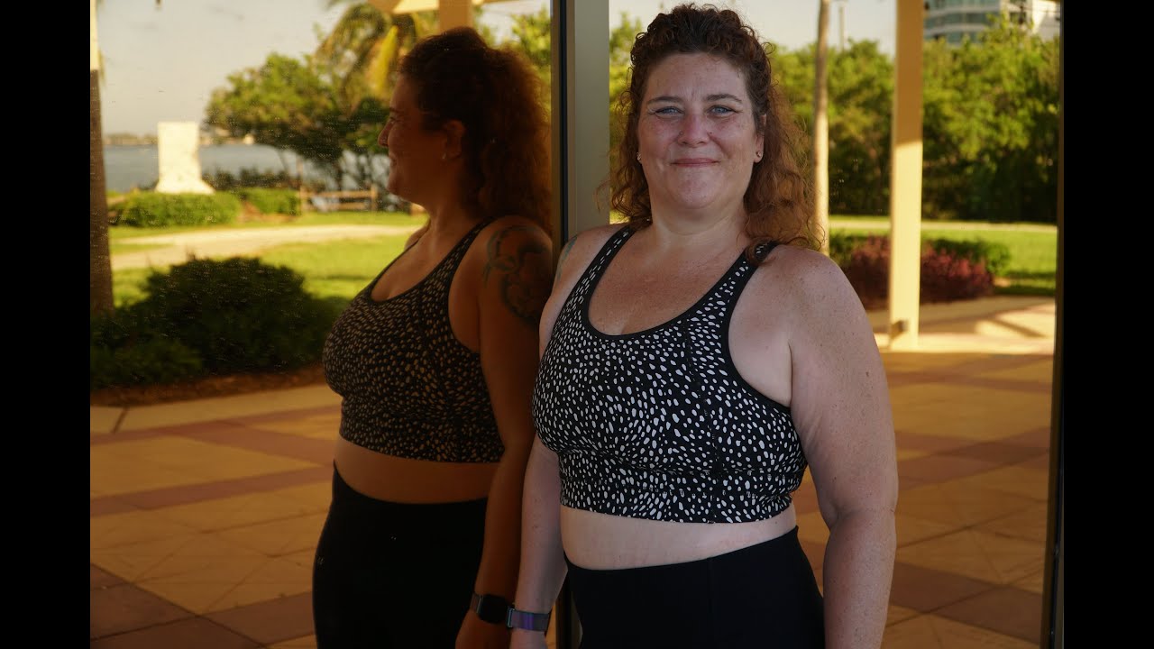 Shelby's story: abdominoplasty after major weight loss