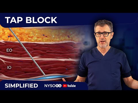 Image of TAP BLOCK - Crash course with Dr. Hadzic