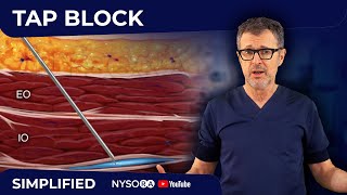 TAP BLOCK - Crash course with Dr. Hadzic