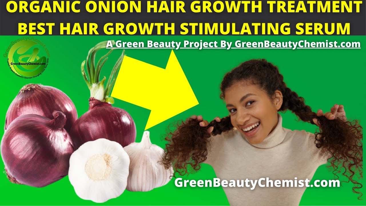DIY ONION HAIR GROWTH SERUM RECIPE - HOW TO GROW LONG HAIR WITH ONION  JUICE, CAYENNE & FLAXSEED GEL - YouTube