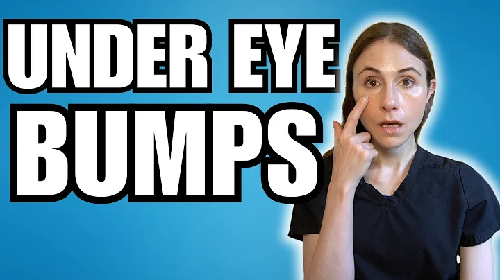 What Are Those Bumps Under The Eyes? | Dermatologist Explains