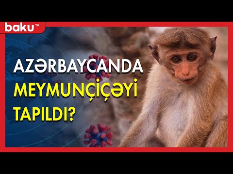 Azərbaycanda meymunçiçəyi tapıldı? - BAKU TV