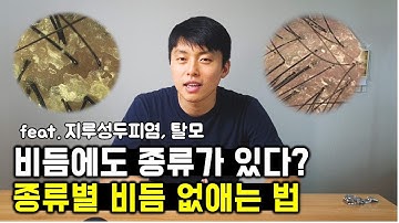 비듬을 없애기 위해 내가 실천하고 있는 것들 ㅣ지루성두피염, 탈모 예방