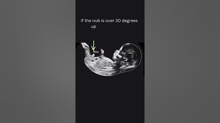 Boy or Girl Gender Reveal | 12th Week Ultrasound | Pregnancy