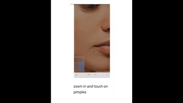 How to remove pimples on face in Snapseed!! Simple Editing tricks!! Clean the face in only 1min!!