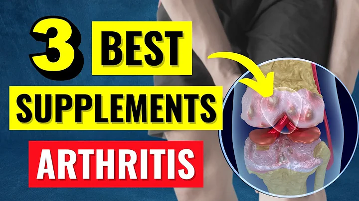 Los 3 mejores suplementos para la artritis que REALMENTE funcionan