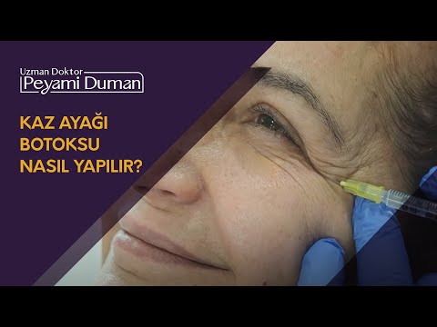 Video: Kaz ayağı anahtarı ne için kullanılır?