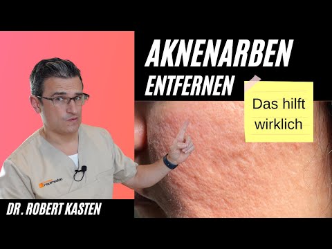 Video: So befolgen Sie die Intervallfasten-Diät: 12 Schritte (mit Bildern)