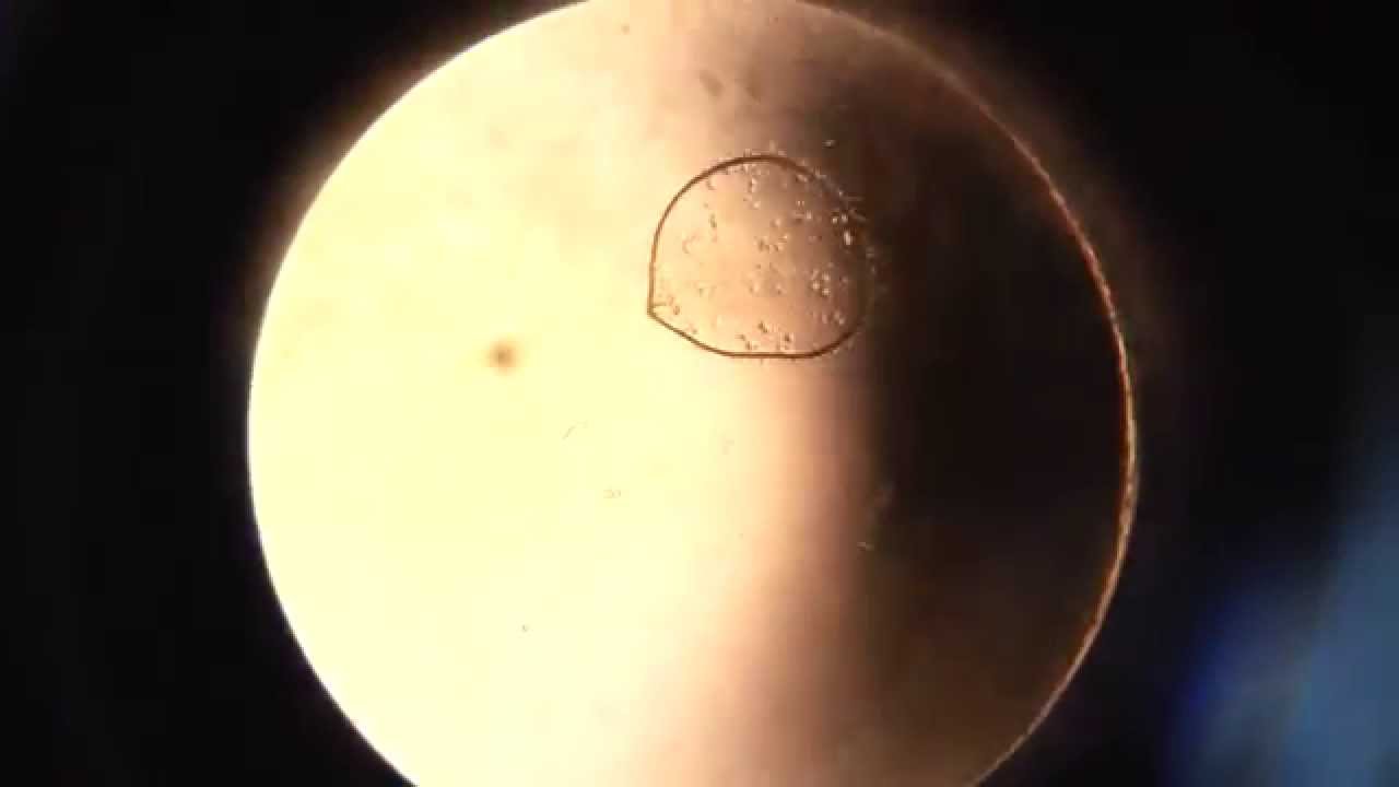 Microbes Vu Au Microscope Youtube