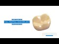 Introducing truexpression veraform by dentsply sirona lab