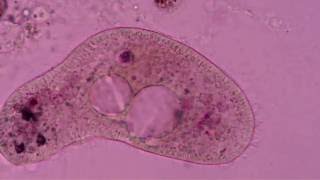 Paramecia dying in amoeba food vacuole