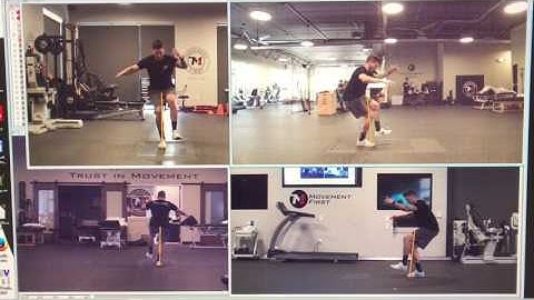 Single Hop Test (ACL Reconstruction Return To Sport Testing)