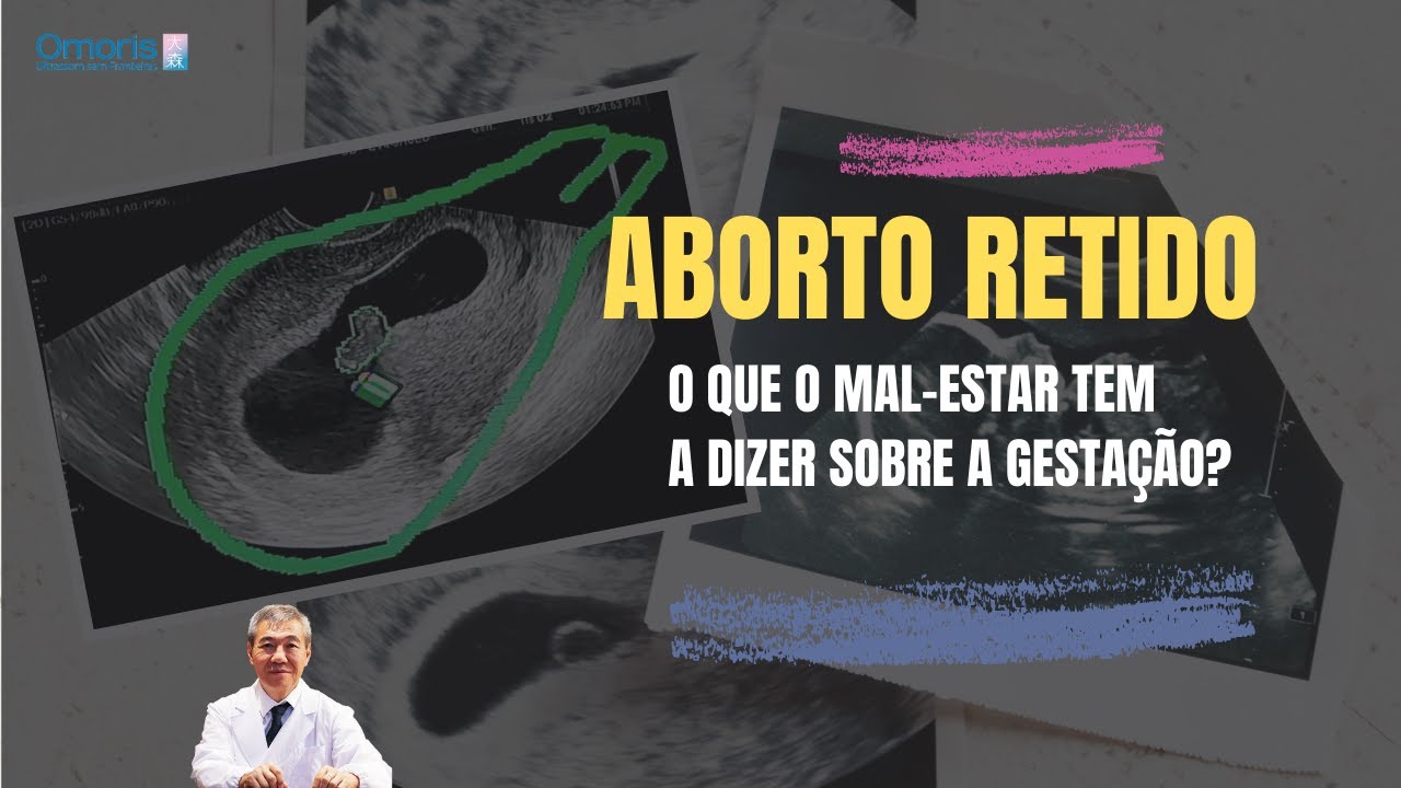 Aborto retido - O que o mal-estar tem a dizer sobre a gestação? - YouTube