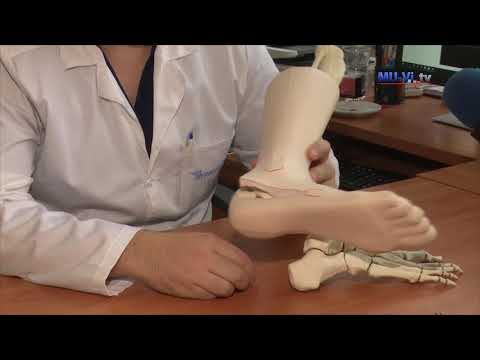 Видео: Как да лекуваме фрактури на костите по-бързо