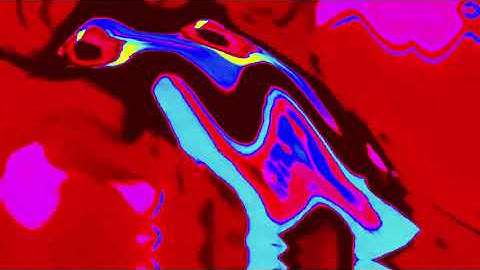 Klasky Csupo In Videoup V18 (Android)