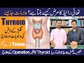 Thyroid problem and solution  how to control thyroid naturally  thyroid home remedy treatment urdu