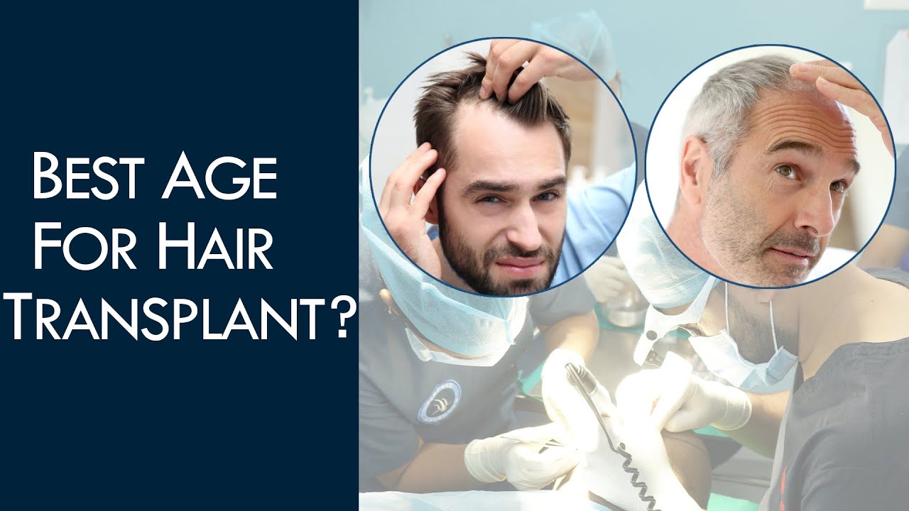 5 Reasons Why Hair Transplants Fail  What Is The Success Rate