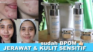 SKINCARE BUAT JERAWAT MEMBANDEL 😭 ERTO'S ACNE EXPERT SERIES REVIEW PAKAI 3 MINGGU | Maria Soelisty