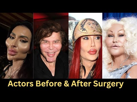 Lara Flynn Boyle's Plastic Surgery:  It's More Than You Think
