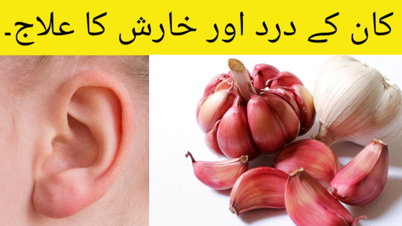 Simple home remedy for ear pain kaan me dard ka ilaj. YouTube