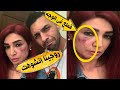 عاجل اصابة الفنانه روجينا فى الوجه اثناء تصوير مسلسل بنت السلطان عاجل اصابة الفنانه روجينا فى الوجه اثناء تصوير مسلسل بنت السلطان