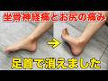 【坐骨神経痛の原因は足首だった】お尻の奥の痛み、痺れも改善