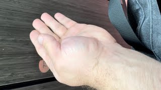 Armwrestling Training Grow Your Thumbs Bigger and Stronger