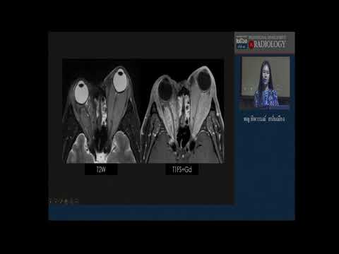 Lecture: Orbital tumors & Lecture: Imaging evaluation  & Case-based : Thyroid nodules