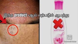 Dabur Rose water review in tamil/ Truth about dabur rose water/worst side effects/ @Organichouse