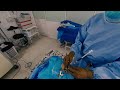 Stereotactic biopsy recorded by stereoscopic camera. 3D_VR