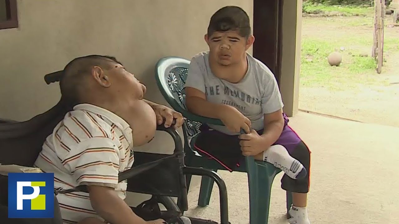 Estos dos hermanos nunca crecieron: son dos hombres atrapados en cuerpos de niños camera iphone 8 plus apk