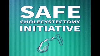 Cholecystectomy/ Spyglass Gallbladder/ Critical View of Safety/ Recurrent Biliary Colic