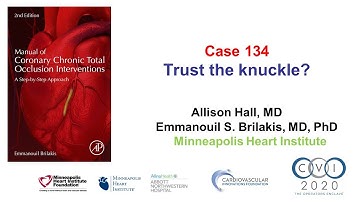 Case 134: Manual of CTO PCI: Trust the knuckle?