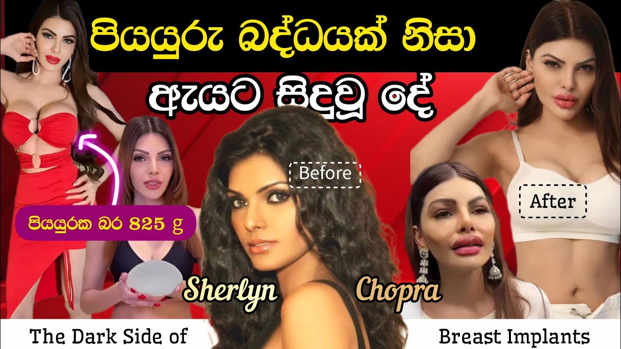 පියයුරු විශාල මදිවූ ඇගේ කතාව - ෂර්ලීන් චොප්‍රා 