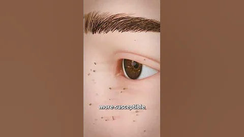 Why You Shouldn T Pluck Your Eyelashes 
