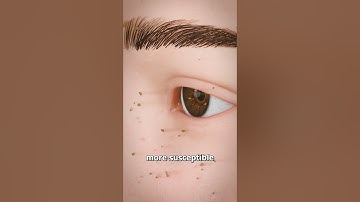 Why You Shouldn’t Pluck Your Eyelashes 😨