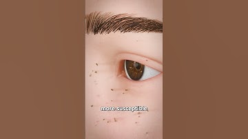 Thumbnail of Why You Shouldn’t Pluck Your Eyelashes 😨