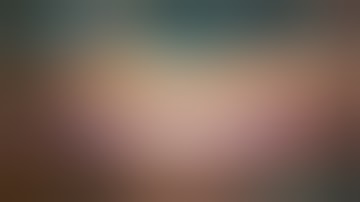 Trans conjunctival small incision cataract surgery-an elegant surgery