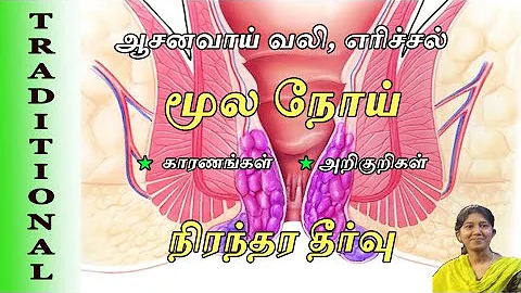 Piles Symptoms in Tamil / Piles treatment at Home ...