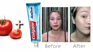 SKIN WHITENING | TOOTHPASTE WITH TOMATO | TOOTHPASTE BEAUTY HACK | by TinGee