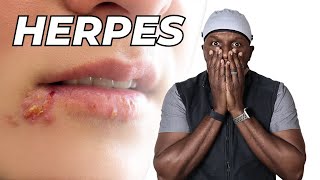 Life After Herpes Diagnosis - What Happens Now?